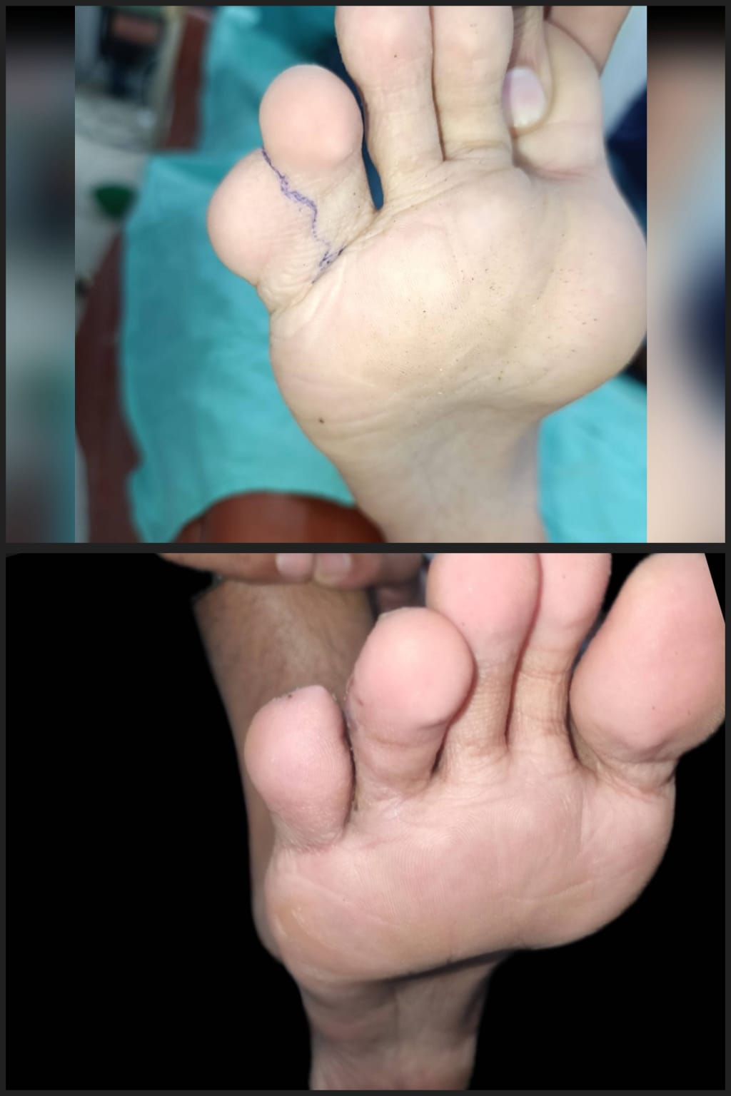 Before & After 45
